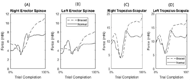 The image depicts four graphs measuring the force in the trapezius and erector spinae muscle during the completion of the block transport. 

Image A measures the right erector spinae muscle. Braced conditions began around 6 mN, fell to 4 mN and rose to 12 mN. Normal conditions began at 4 mN before decreasing to 3 mN and sharply rising to approximately 8 mN and leveling out.

Image B measures the left erector spinae muscle. Braced conditions began around 5 mN, and slowly rose to 8 mN. Normal conditions began around 3 mN before sharply increasing to 6 mN and leveling out around 5 mN.

Image C measures the muscle between the right trapezius and scapular nodes. Braced conditions began around 10 mN, rose to 13 mN, then drooped to 4 mN before rising to 18 mN and leveled off. Normal conditions followed a similar pattern. Normal began around 8 mN, rose to 10 mN, then drooped to 4 mN before rising to 14 mN and falling to 13 mN to level out. At time of pick up, both conditions slightly increased force.

Image D measures the muscle between the left trapezius and scapular nodes. Braced conditions began around 10 mN, rose to 13 mN, then drooped to 6 mN before rising to 17 mN and leveled off. Normal conditions followed a similar pattern. Normal began around 8 mN, rose to 10 mN, then dropped to 6 mN before rising to 14 mN and falling to 12 mN to level out. At time of pick up, both conditions slightly increased force.