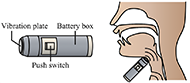  Schematic diagram of an electrolarynx and its usage. A schematic diagram of the electrolarynx is shown on the left side of the figure. The Vibration plate is located at the left end of the long, narrow, cylindrical body that is tilted horizontally, the push switch is in the center, and the battery box is on the right side. There is a schematic of a person when using an electrolarynx on the right side of the figure. The figure depicts the vibrating plate of the electrolarynx being pressed against the border between the jaw and neck, and the vibrations of the plate being transmitted into the oral cavity.