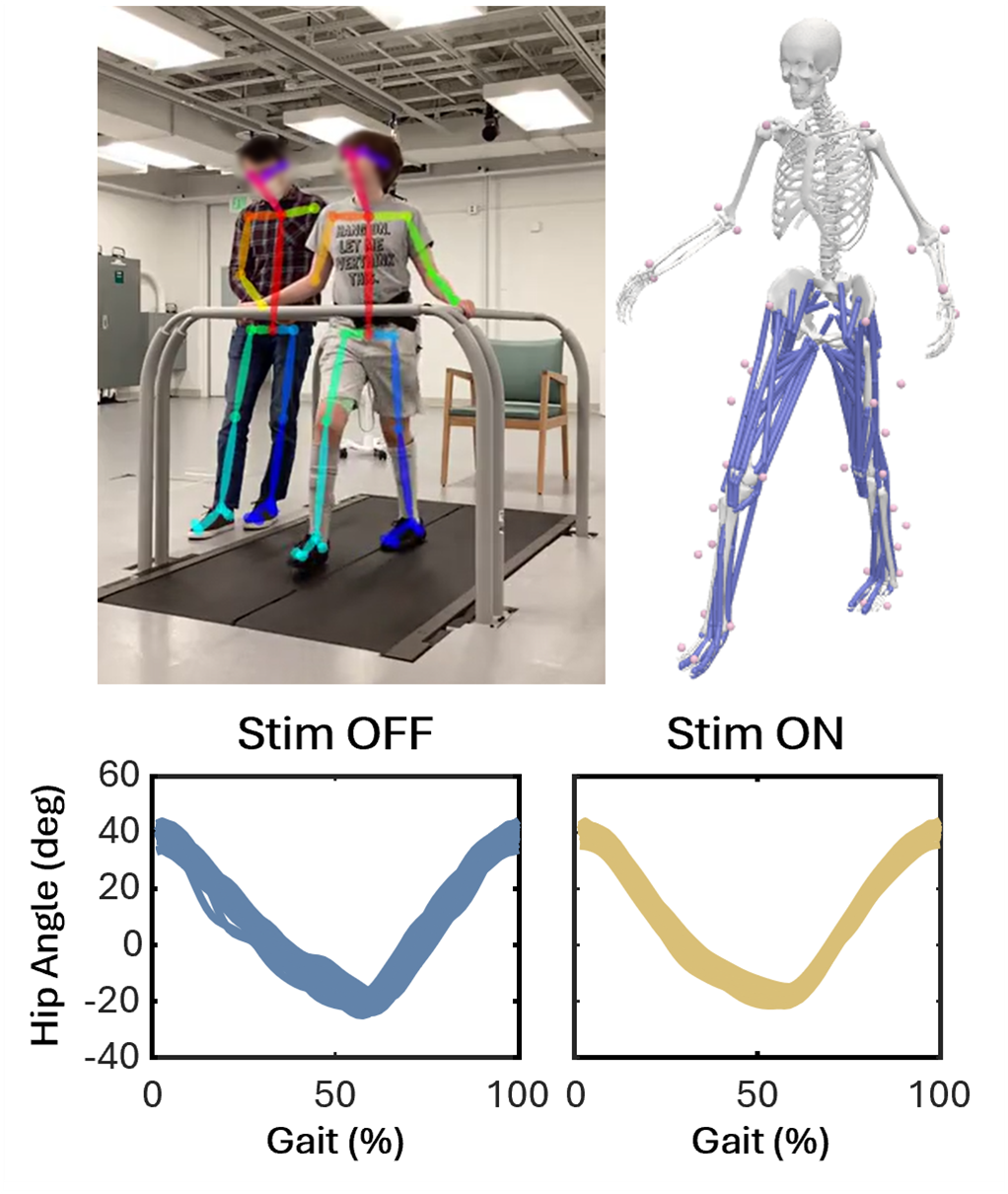 The figure has three components. The top left component includes a still frame of a participant on a treadmill and a researcher to their side, with their faces blurred, and two stick figures laid over them that represent the OpenCap’s 2D poste estimation algorithm. The figure shows that the algorithm is effective at identifying both the participant and the researcher, with algorithm markers, such as hips, shoulders, and knees, overlaid with the actual anatomical parts of the person being tracked. The top right section of the figure contains an OpenSim skeleton that represents the model of the participant walking on the treadmill with markers on the model identified from the markerless motion capture system (i.e., OpenCap). The bottom section of the figure shows the hip kinematics (i.e., angle in degrees) plotted for a gait cycle with spinal stimulation OFF and ON. Multiple gait cycles are plotted for each condition and show that OpenCap is able to track hip kinematics consistently across gait cycles.