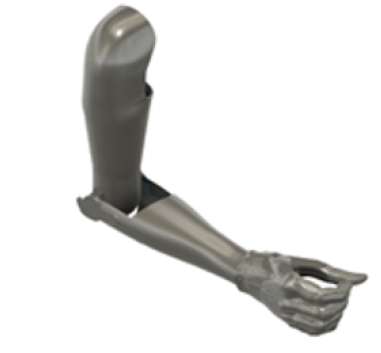 Figure 1: CAD prosthetic model.