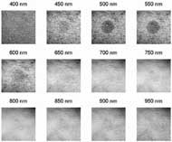 The best, cropped image for each filter is shown for a single subject. The erythema is most visible in the 450 &ndash; 600nm filtered images, and has varied visibility in other filters. 